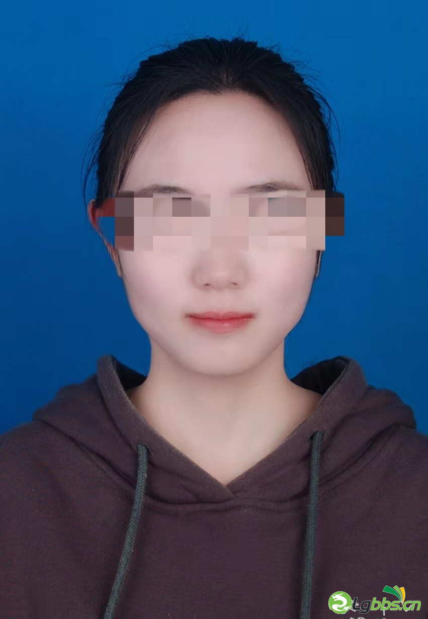 231248dt7xu09x8u30vt8u.png