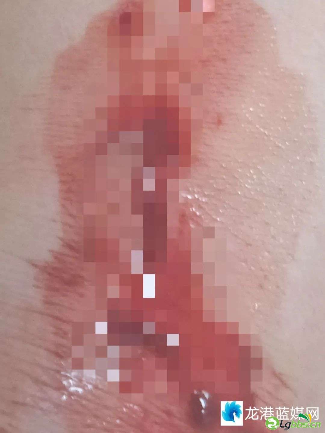 043031rqes57vvquzwj1jt.jpeg