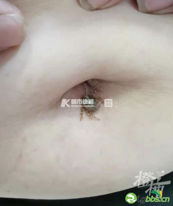044156afnfwbr2nq688bf8.png