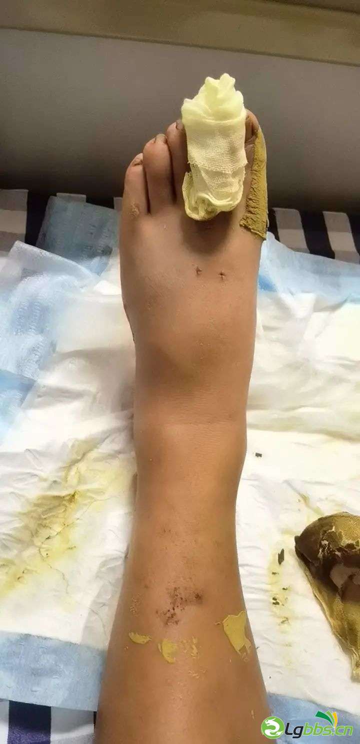 094620g3h85bdspa81czd0.jpeg
